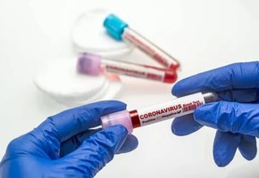 О проведении тестирования на новую коронавирусную инфекцию в Красноярском крае