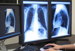 СУЭК поддерживает медицину регионов в условиях пандемии коронавируса