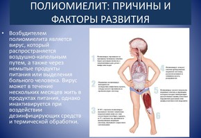 Внимание -полиомиелит