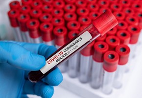 Шарыповские врачи готовятся к приходу штамма коронавируса «омикрон»